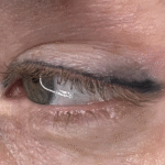 Can you do saline removal on eyeliner?