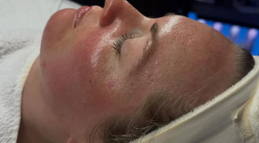Does a HydraFacial Work Immediately